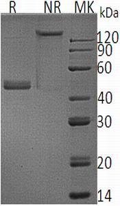 Human IL17B/IL20/NIRF/ZCYTO7 (Fc tag) recombinant protein