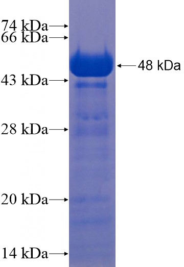Recombinant Human CCDC62 SDS-PAGE