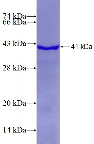 Recombinant Human Histone H2A.X SDS-PAGE