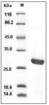 Human GSTM2 / GST4 Protein (His Tag) SDS-PAGE