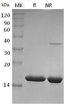 Human FABP4 (His tag) recombinant protein
