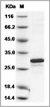 Human MERTK / Mer(aa 578-872) Protein SDS-PAGE