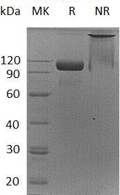 Human EGFR/ERBB/ERBB1/HER1 (Fc tag) recombinant protein