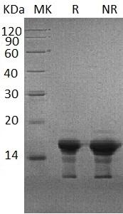 Human SNCG/BCSG1/PERSYN/PRSN recombinant protein