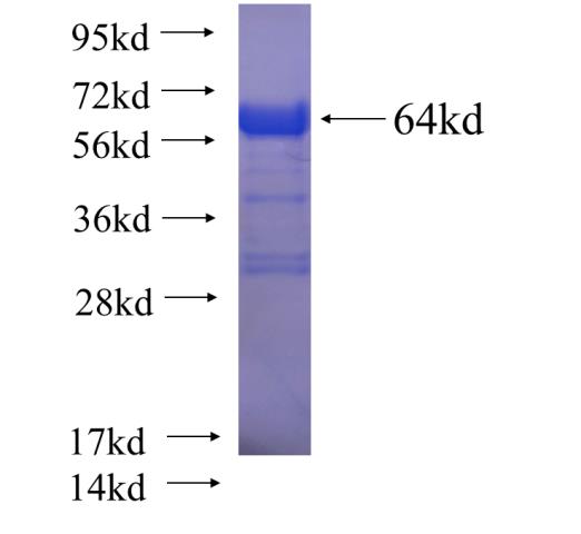 Recombinant human SESTD1 SDS-PAGE