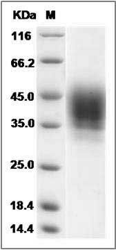 Rat CD48 / SLAMF2 / BCM1 Protein (His Tag) SDS-PAGE