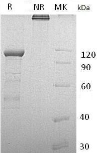Human CDH11/hCG_26636 (Fc & His tag) recombinant protein