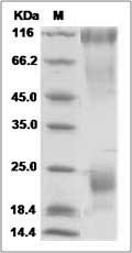Ebola virus EBOV (subtype Zaire, strain H.sapiens-wt/GIN/2014/Kissidougou-C15) GP / Glycoprotein Protein (His Tag)