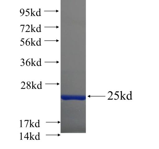 Recombinant human DEPDC7 SDS-PAGE