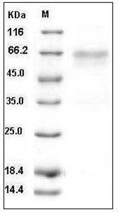 Mouse HVEM / TNFRSF14 Protein (His & Fc Tag) SDS-PAGE