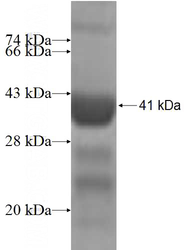Recombinant Human RPS24 SDS-PAGE
