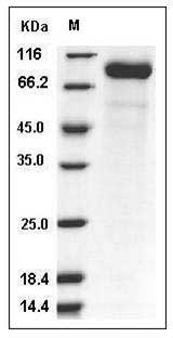 Influenza B (B/Malaysia/2506/2004) Hemagglutinin / HA Protein (His Tag) SDS-PAGE