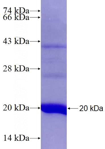 Recombinant Human FADS2-Specific SDS-PAGE