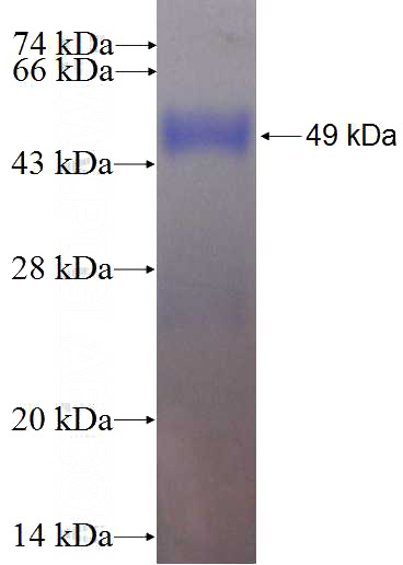 Recombinant Human TRIM11 SDS-PAGE