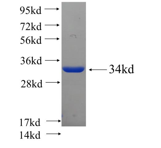 Recombinant human C13orf37 SDS-PAGE