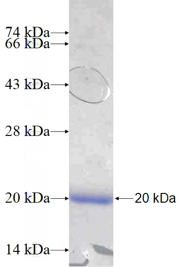Recombinant Human TRMT2B SDS-PAGE