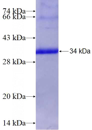 Recombinant Human TRIM56 SDS-PAGE