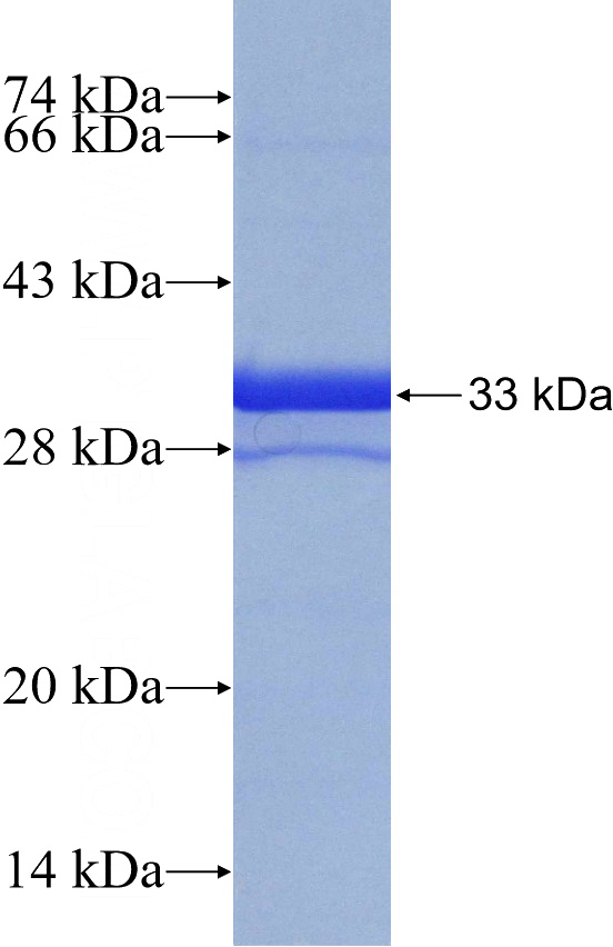 Recombinant Human PDE6A SDS-PAGE