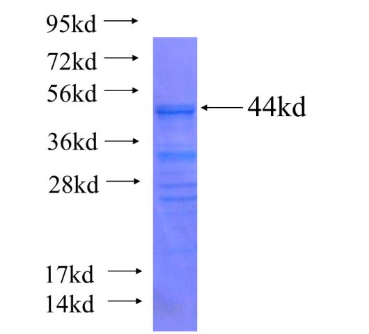 Recombinant human KDM5C SDS-PAGE
