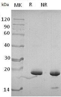 Human PIN4 (His tag) recombinant protein