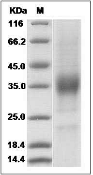 Human KIR2DL4 / CD158D Protein SDS-PAGE