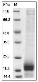 Mouse AGRP / AgRP Protein (His Tag) SDS-PAGE