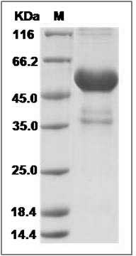 Human Cardiotrophin-1 / CTF1 Protein (Fc Tag) SDS-PAGE