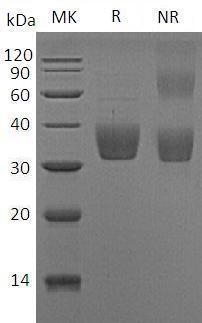 Mouse Slamf8/Blame (His tag) recombinant protein