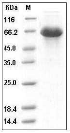 Human SerpinD1 Protein (His Tag) SDS-PAGE