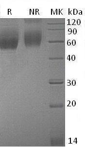 Mouse Il1rl1/Ly84/St2/Ste2 (His tag) recombinant protein