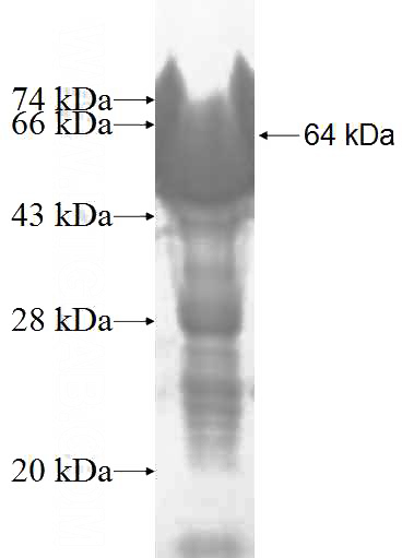 Recombinant Human HMBOX1 SDS-PAGE