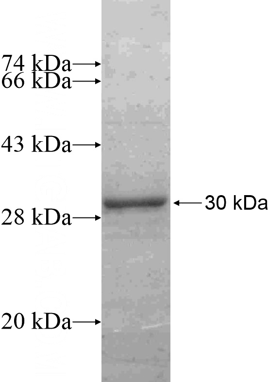 Recombinant Human VENTX SDS-PAGE