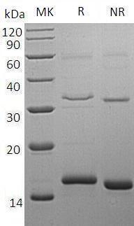 Human CST4 (His tag) recombinant protein