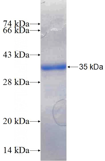 Recombinant Human PANK3 SDS-PAGE