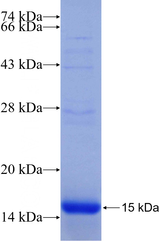 Recombinant Human E2F3 SDS-PAGE