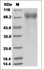Influenza A H3N2 (A/Chiang Rai/277/2011) Hemagglutinin / HA1 Protein (His Tag)