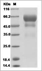 Human PSAP / Prosaposin Protein (His Tag)