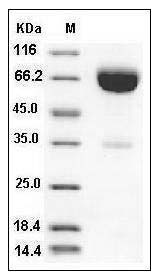 Human IFNAR2 / IFNABR Protein (Fc Tag) SDS-PAGE