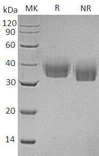 Human LILRA5/ILT11/LILRB7/LIR9 (His tag) recombinant protein