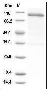Human Nogo Receptor / NOGOR / RTN4R Protein (His & Fc Tag) SDS-PAGE