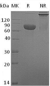 Mouse Crlf2/Crlm2/Tpte2/Tslpr (Fc tag) recombinant protein