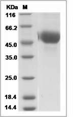 Influenza A H5N8 (A/turkey/Germany-MV/R2472/2014 (H5N8)) Hemagglutinin / HA1 Protein (His Tag)