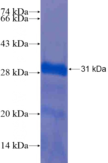 Recombinant Human IL-27 SDS-PAGE