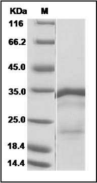 Influenza A H1N1 (A/Brevig Mission/1/1918) Matrix protein 1 / M1 Protein (His Tag) SDS-PAGE