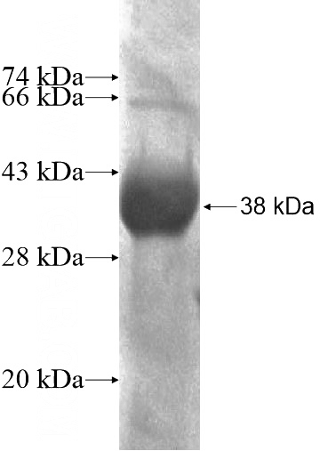 Recombinant Human KAZALD1 SDS-PAGE