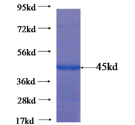 Recombinant human ATP6V1B2 SDS-PAGE