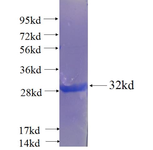 Recombinant human FAM122A SDS-PAGE