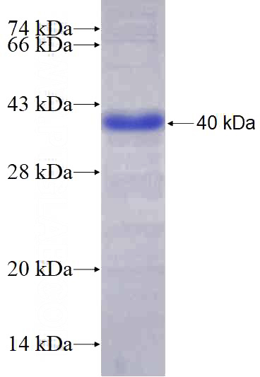 Recombinant Human PPP4R1 SDS-PAGE