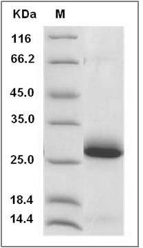 Rat Ephrin-A1 / EFNA1 Protein (His Tag) SDS-PAGE