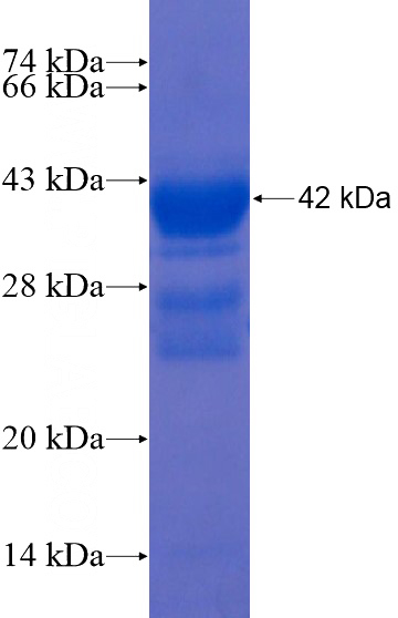 Recombinant Human MATN3 SDS-PAGE